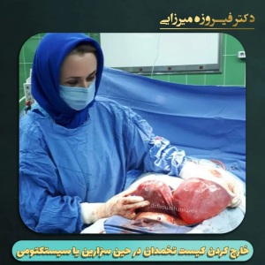 سیستکتومی-3