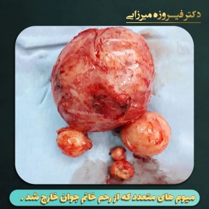 میومکتومی-4