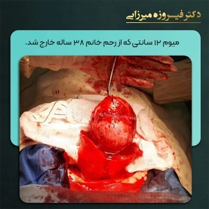 میوم-23