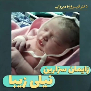 زایمان-سزارین-18