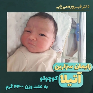 زایمان-سزارین-2