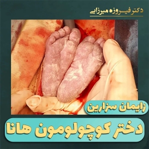 زایمان-سزارین-4