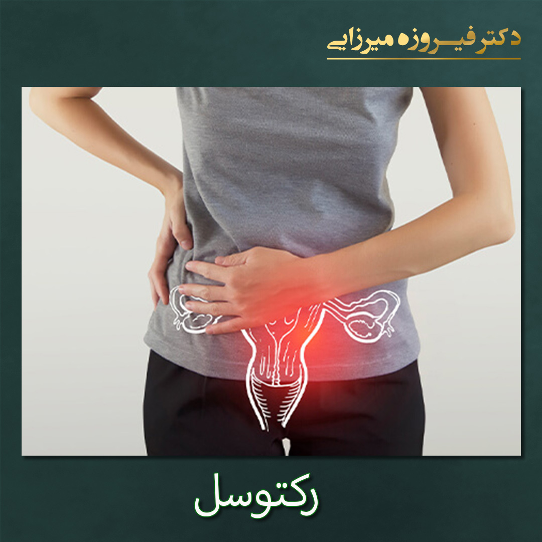 رکتوسل - دکتر فیروزه میرزایی