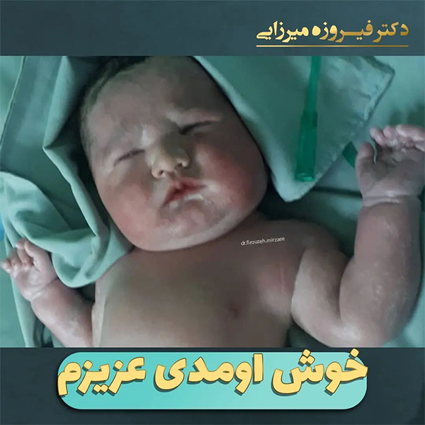 زایمان سزارین - دکتر میرزایی