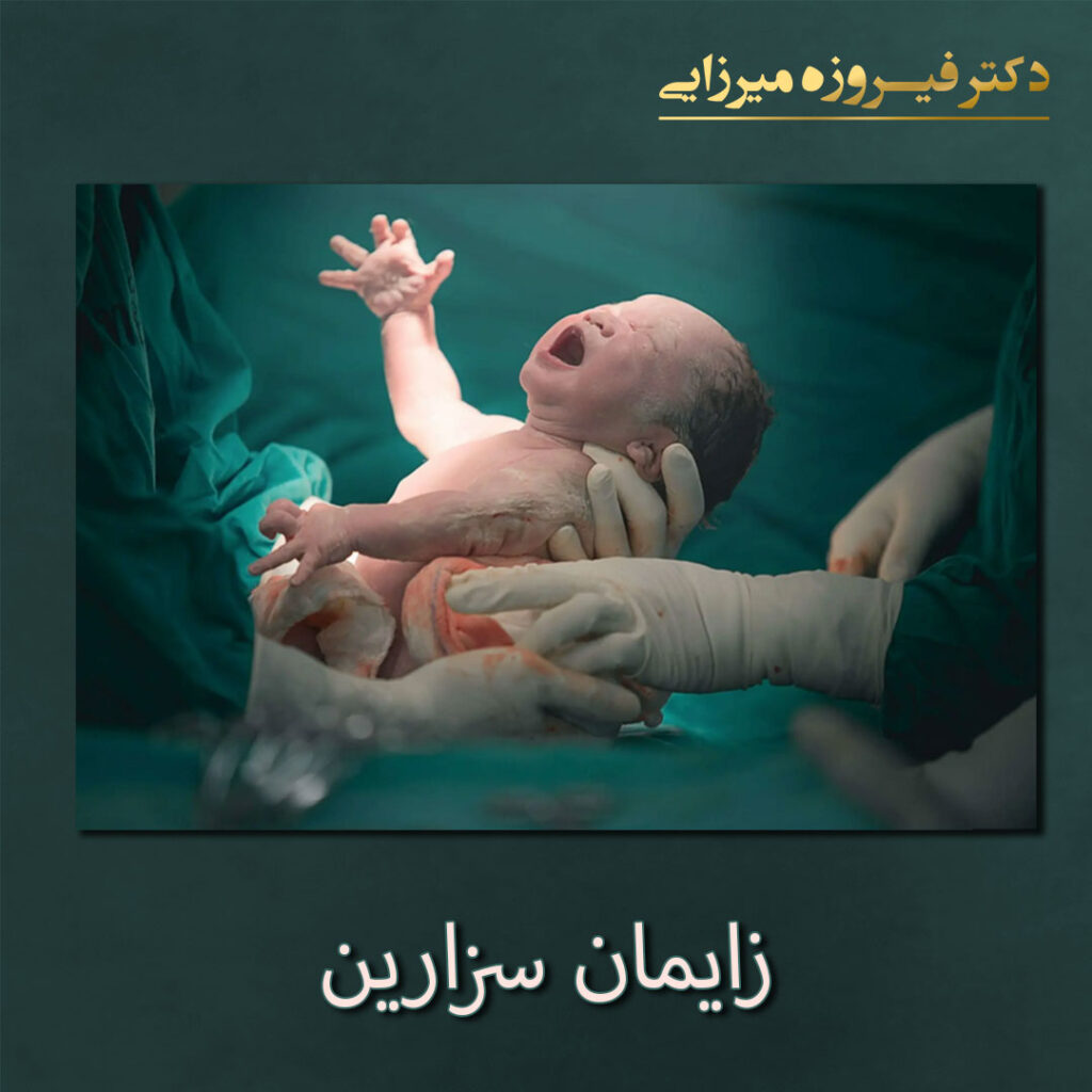 زایمان سزارین - دکتر فیروزه میرزایی