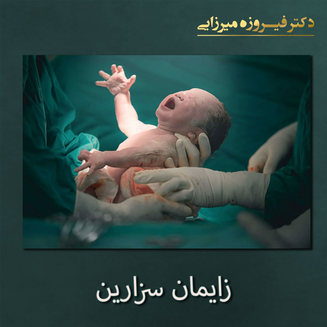 زایمان سزارین - دکتر فیروزه میرزایی