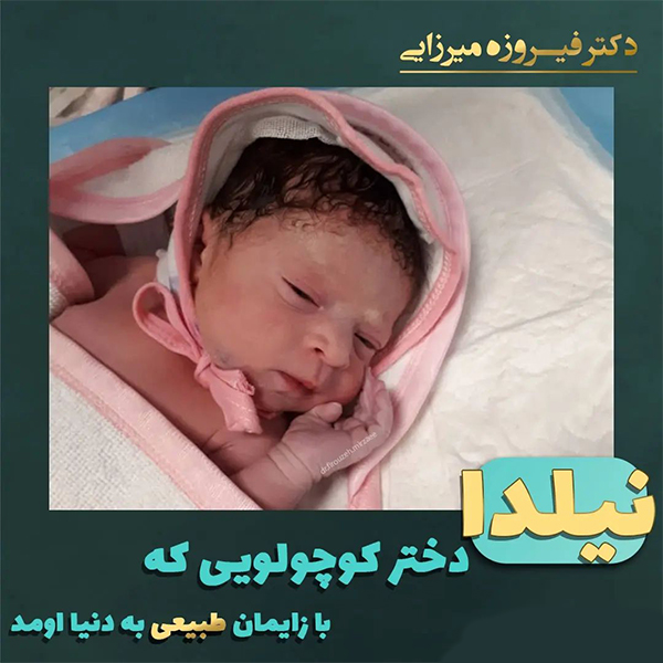 زایمان طبیعی - دکتر میرزایی