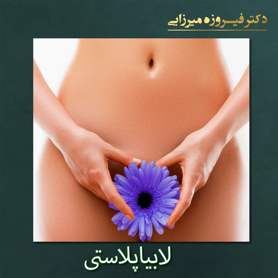 لابیاپلاستی - دکتر فیروزه میرزایی