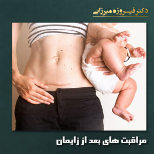 مراقبت های بعد از زایمان - دکتر میرزایی