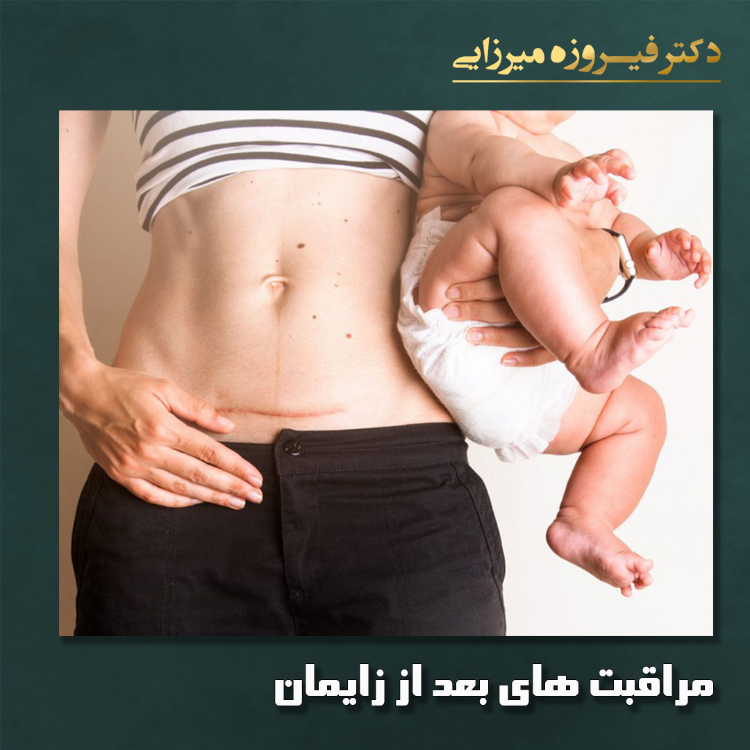 مراقبت های بعد از زایمان - دکتر میرزایی