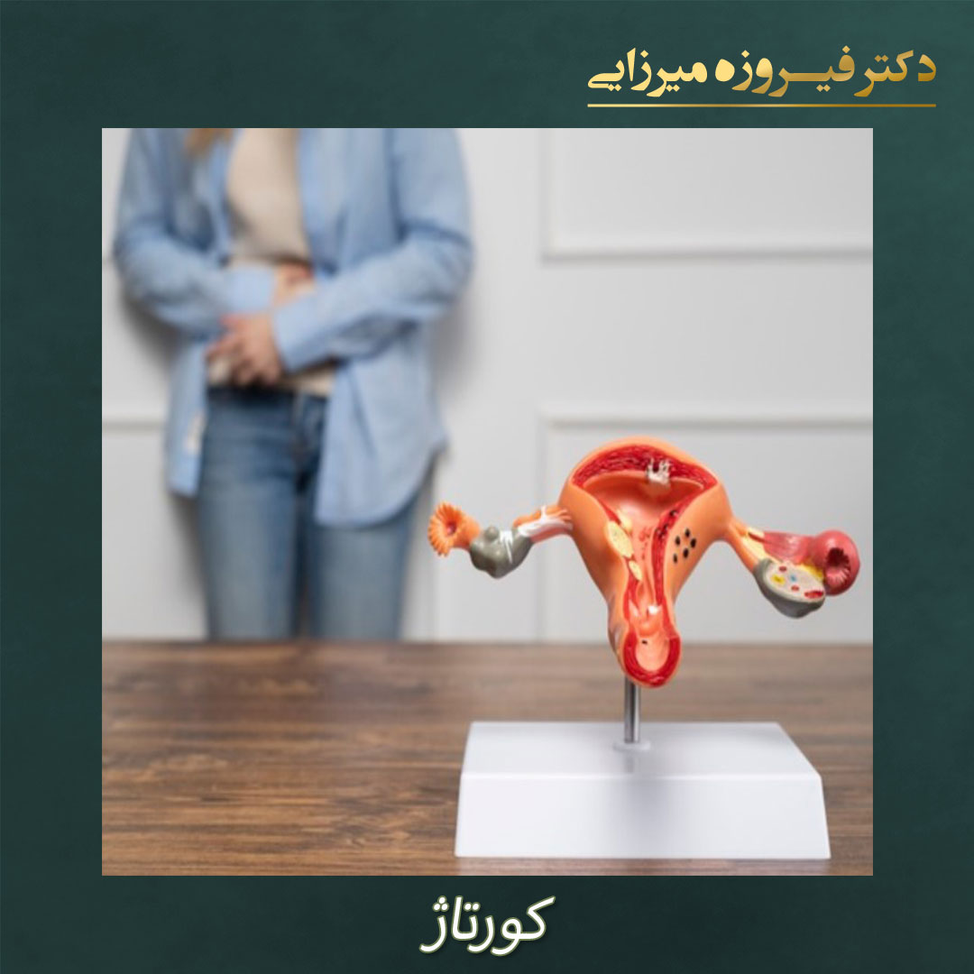 کورتاژ - دکتر فیروزه میرزایی