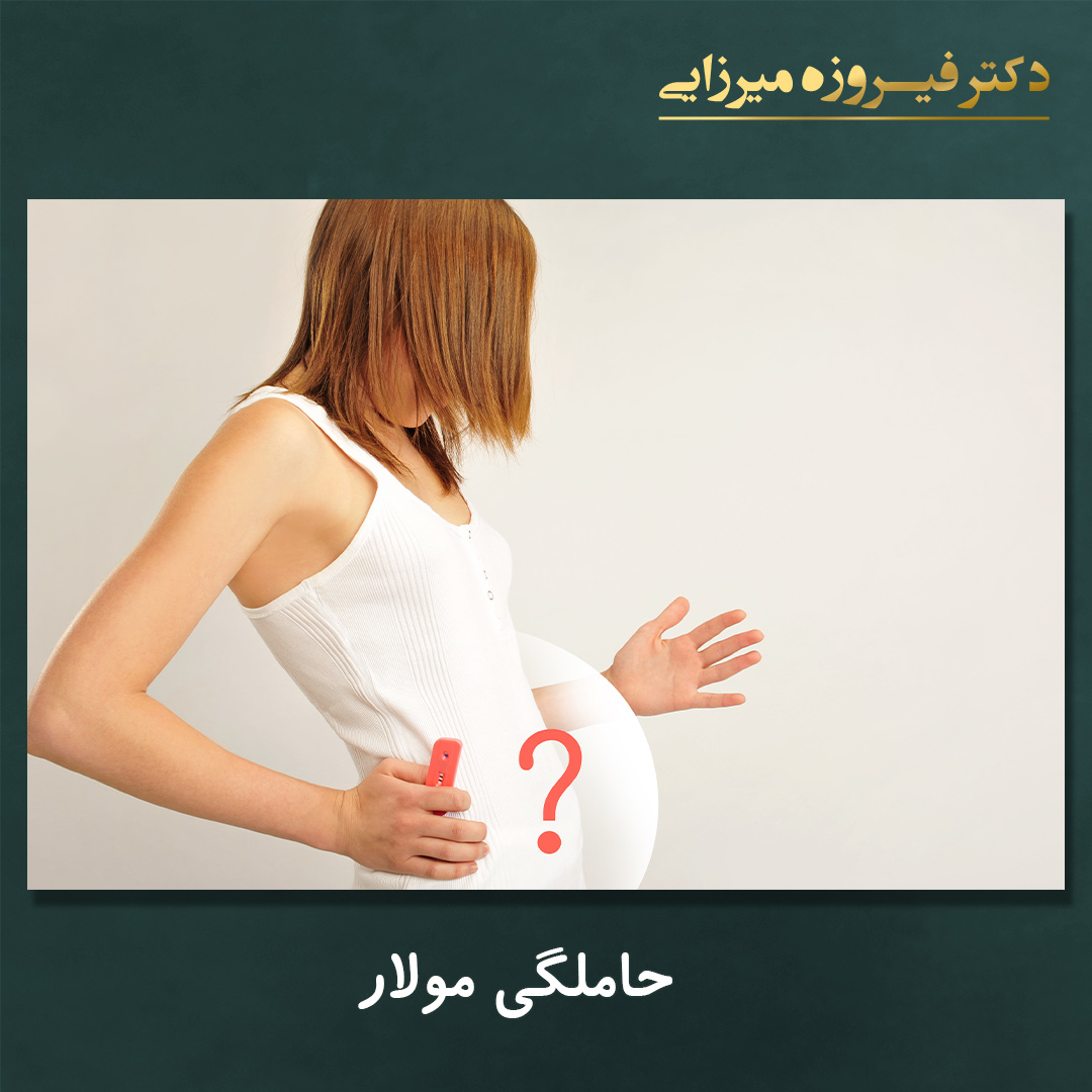 حاملگی مولار - دکتر میرزایی