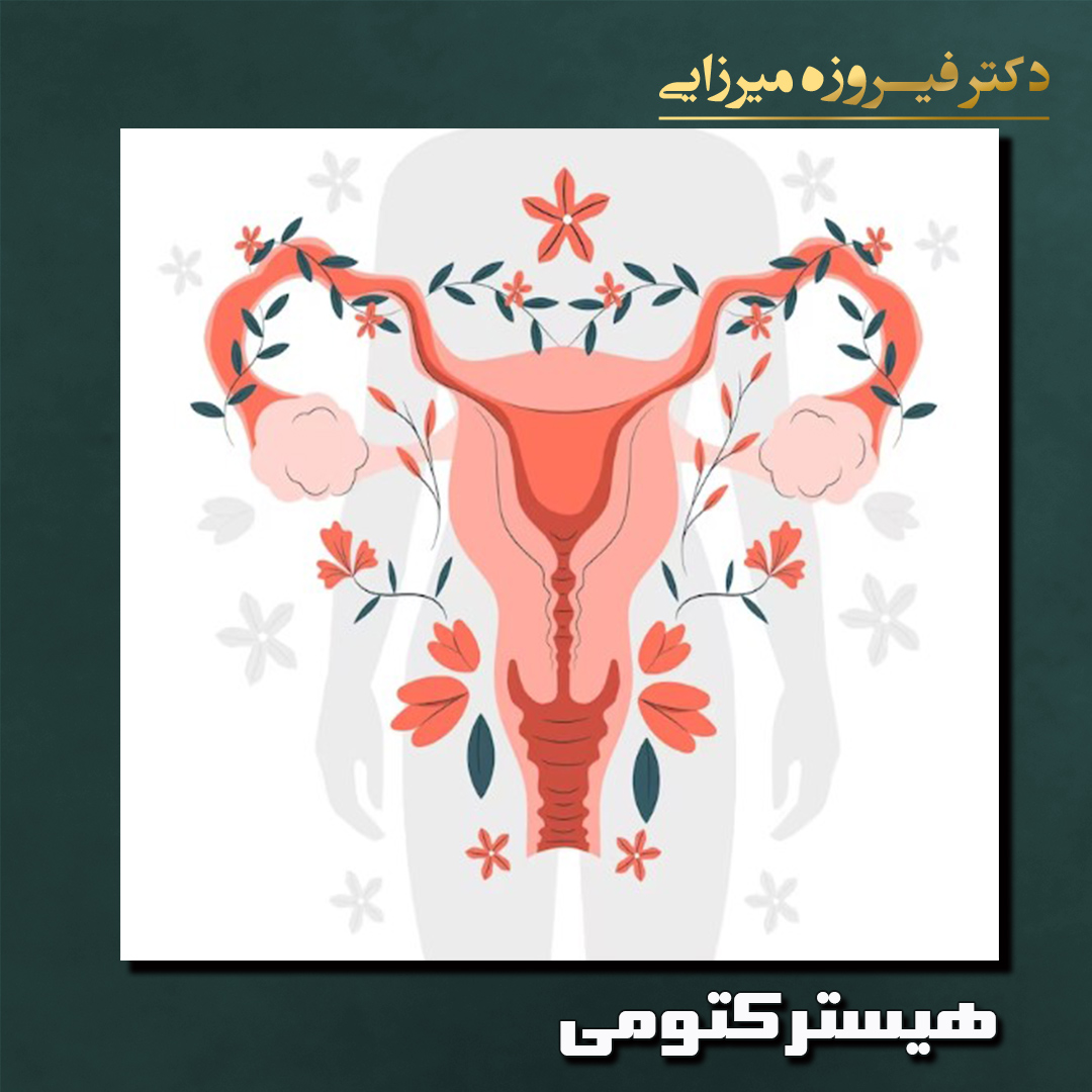 هیسترکتومی - دکتر فیروزه میرزایی