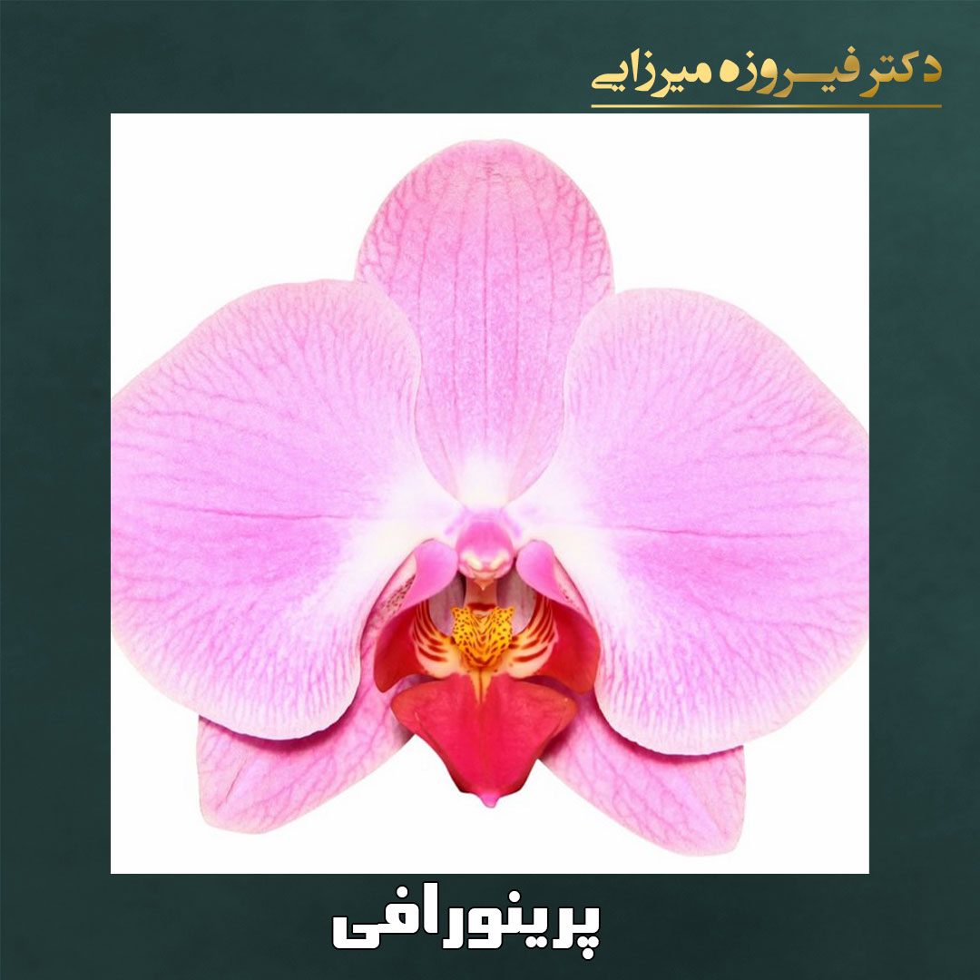 پرینورافی - دکتر میرزایی