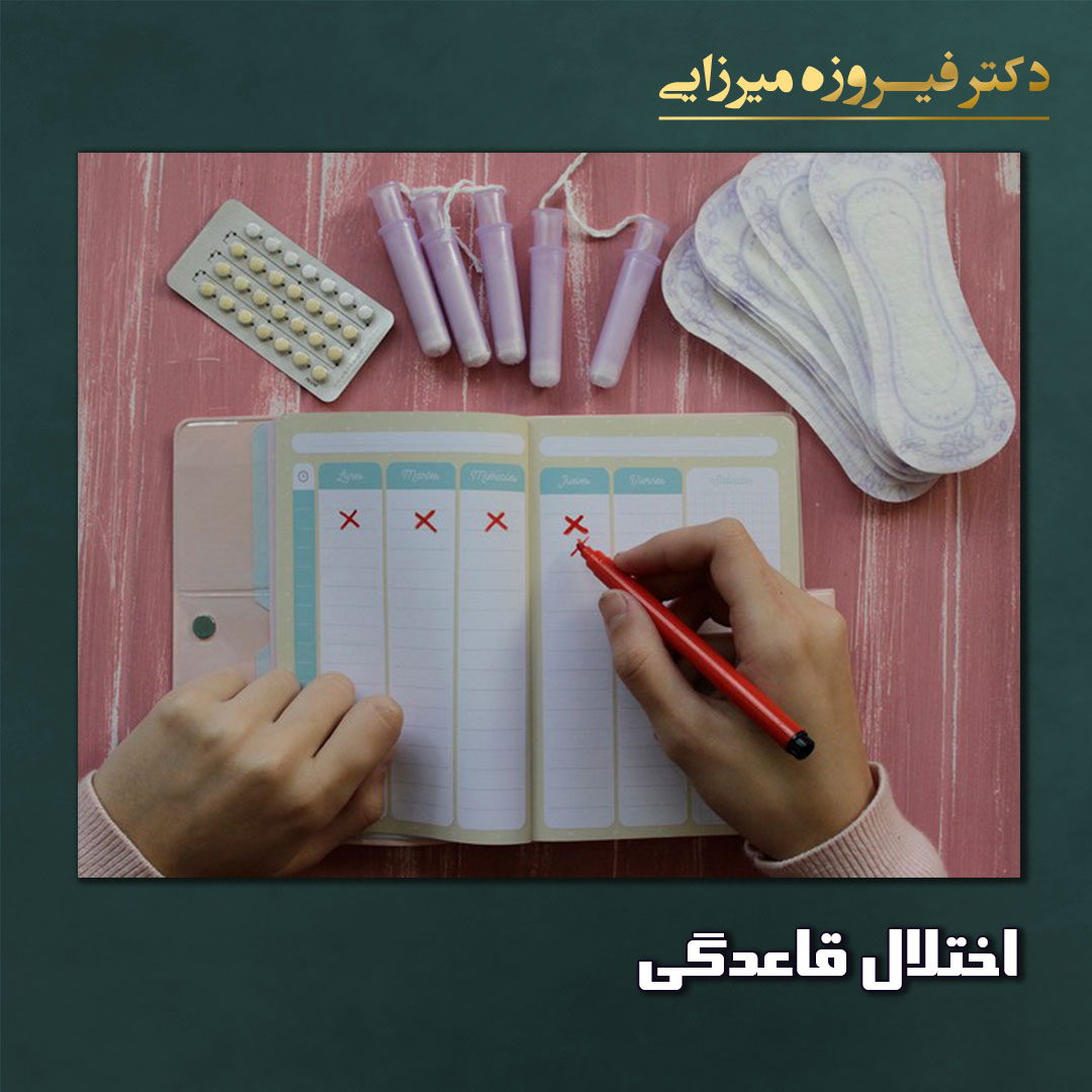 اختلال قاعدگی - دکتر میرزایی