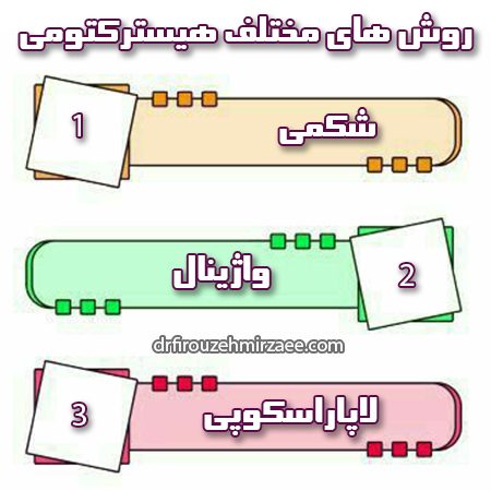 هیسترکتومی - دکتر میرزایی