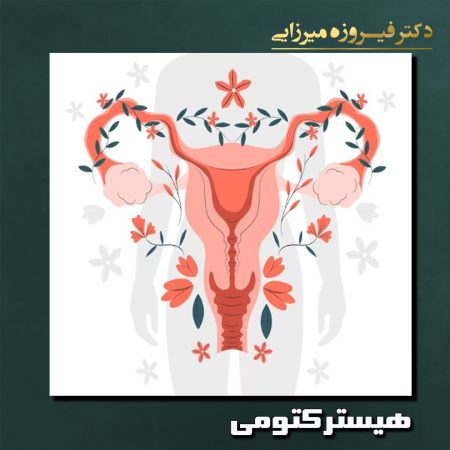 هیسترکتومی - دکتر فیروزه میرزایی